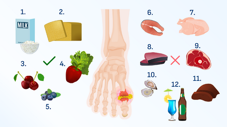 Gout disease diet